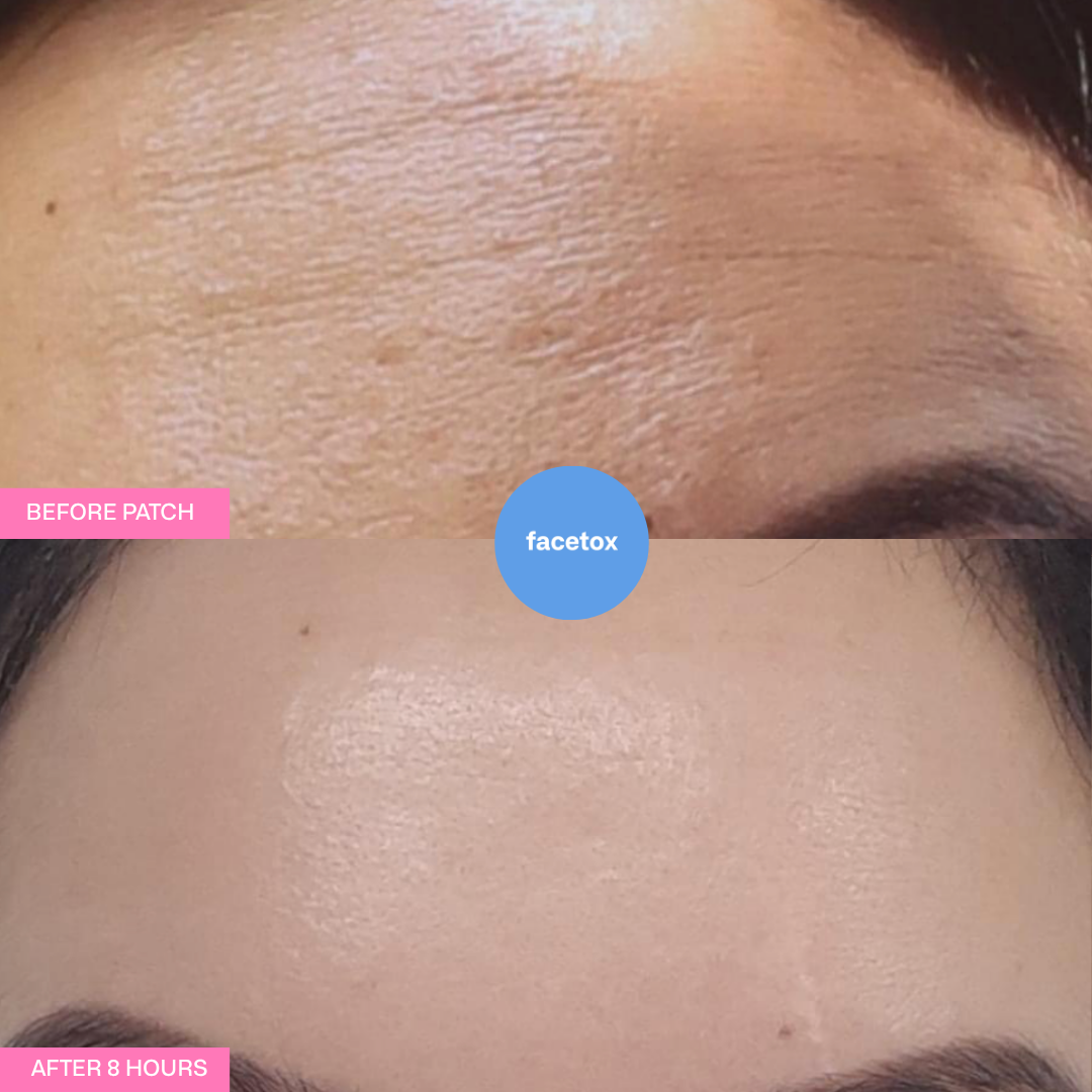 Facetox Forehead + Frown Lines Silicone Wrinkle Patch