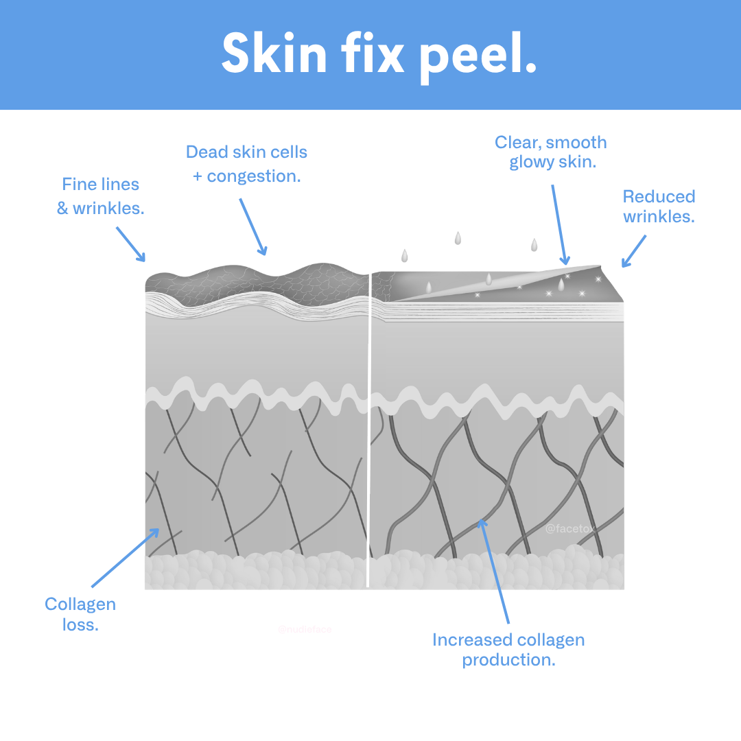 Skin Fix Peel - At Home Chemical Peel