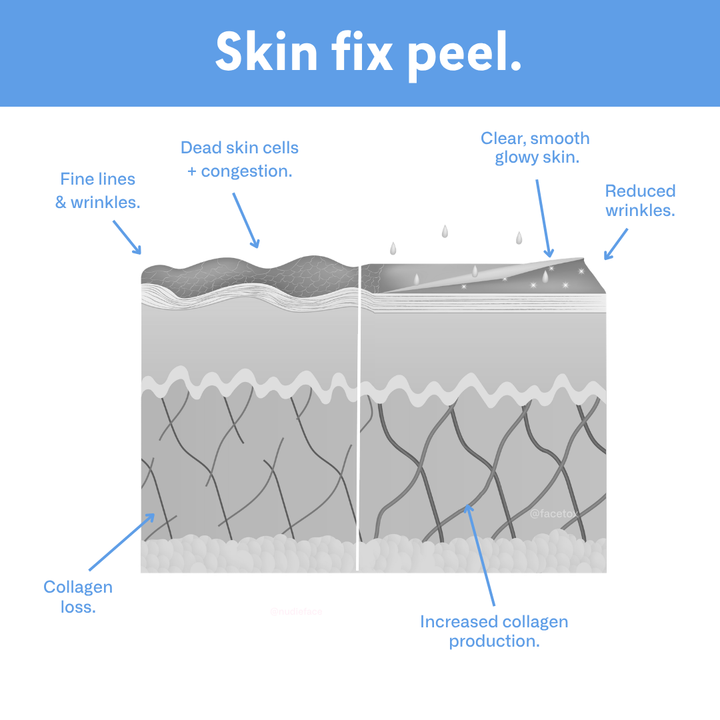 Skin Fix Peel - At Home Chemical Peel