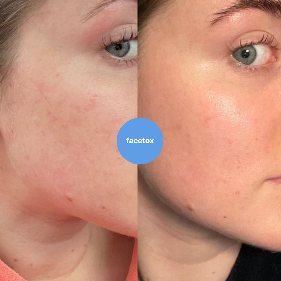 Skin Booster Serum