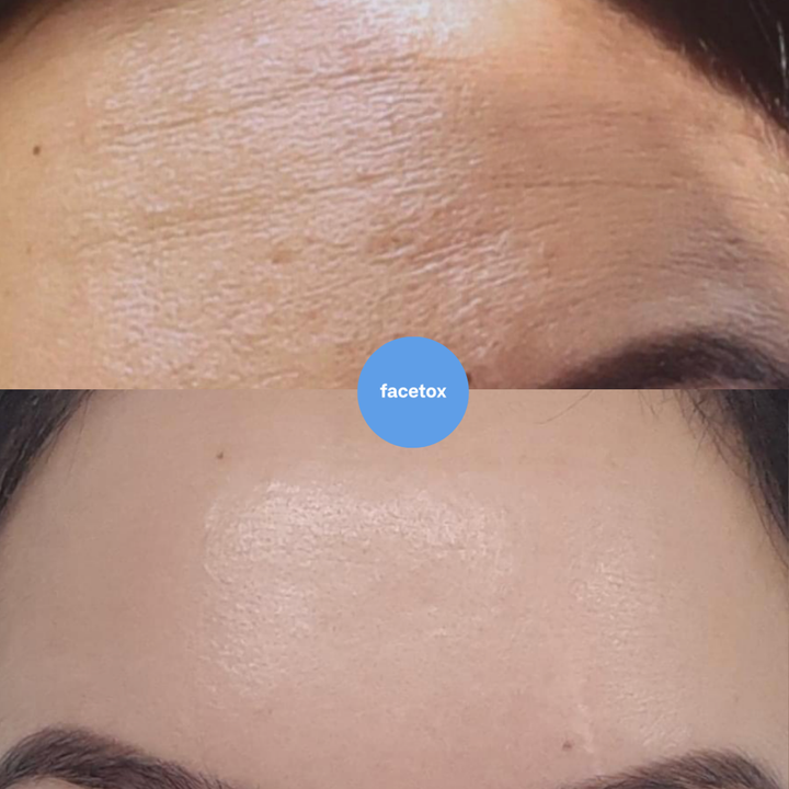 Facetox Anti-Wrinkle Kit