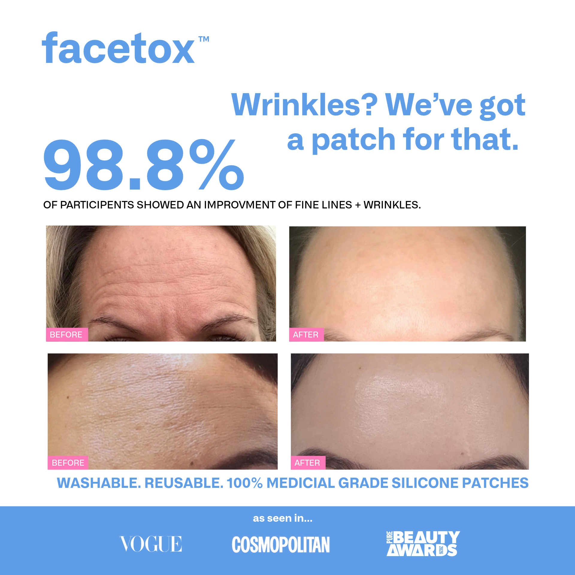 Facetox Forehead + Frown Lines Silicone Wrinkle Patch